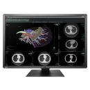 Eizo RadiForce RX660 - 30" 6 MP Befundungsmonitor (Farbe)