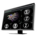 Eizo RadiForce RX660 - 30" 6 MP Befundungsmonitor (Farbe)