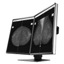 Eizo RadiForce GX560 MammoDuo Graustufen-Monitor mit 5 MP