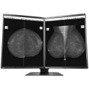 Eizo RadiForce GX560 MammoDuo Graustufen-Monitor mit 5 MP