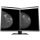 Eizo RadiForce GX560 MammoDuo Graustufen-Monitor mit 5 MP