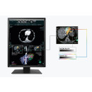 Eizo RadiForce MX217-SB - Monitor für Dental-Befundungsräume und Schnittbilder (CT/MRT)